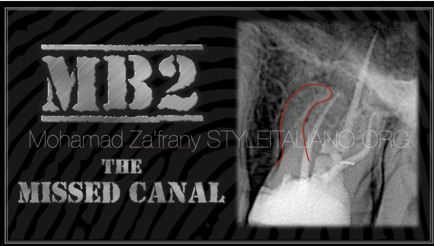 MB2: The Most Famous Missed Canal
