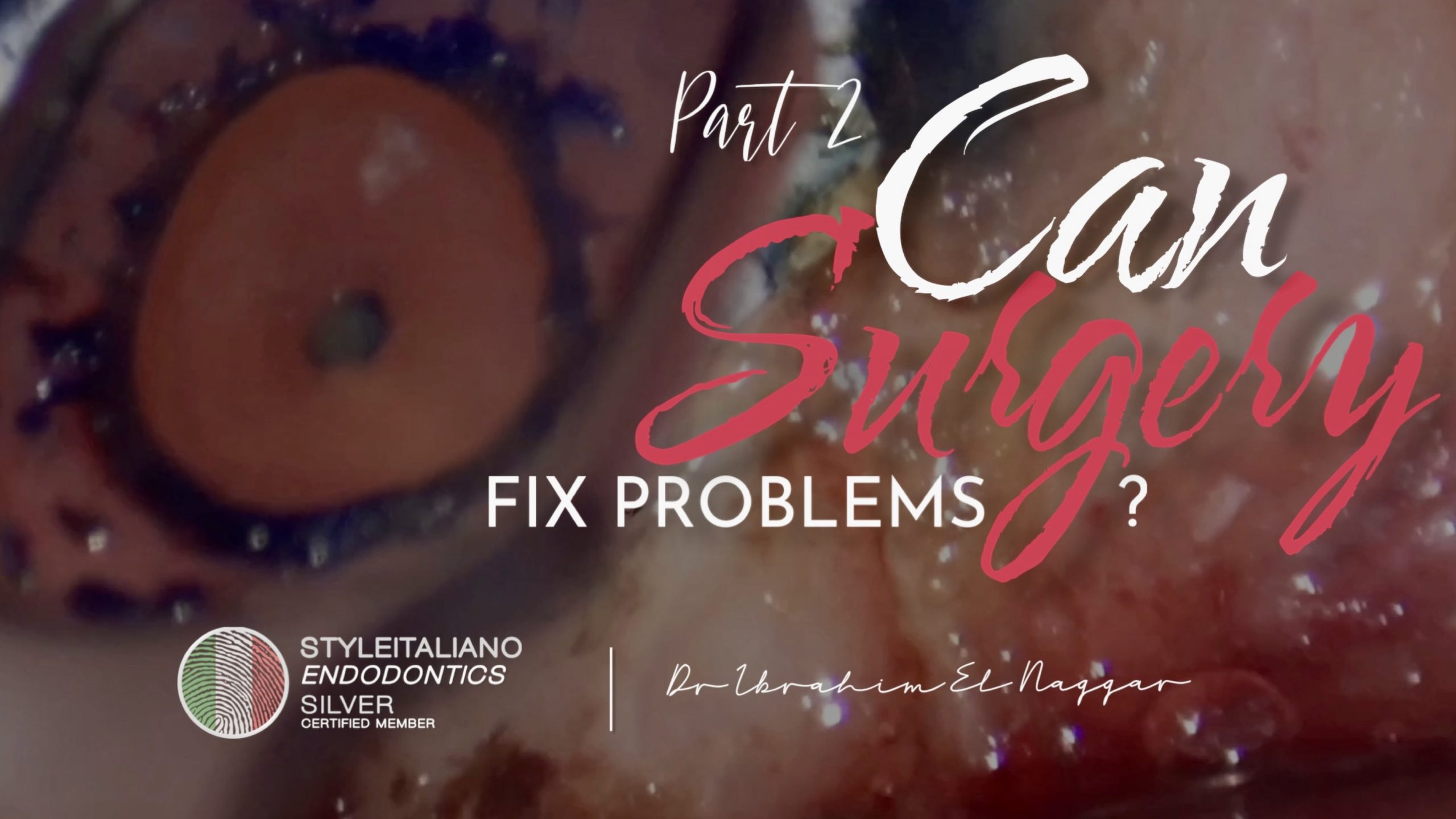 Can Surgery  Fix Problems? Part 2