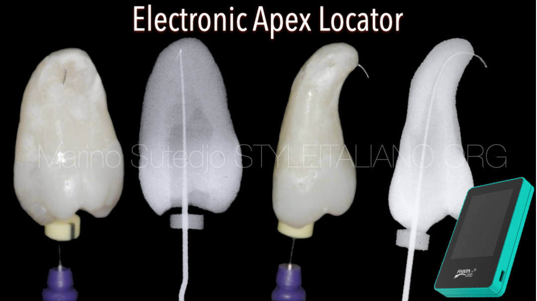 Electronic Apex Locator