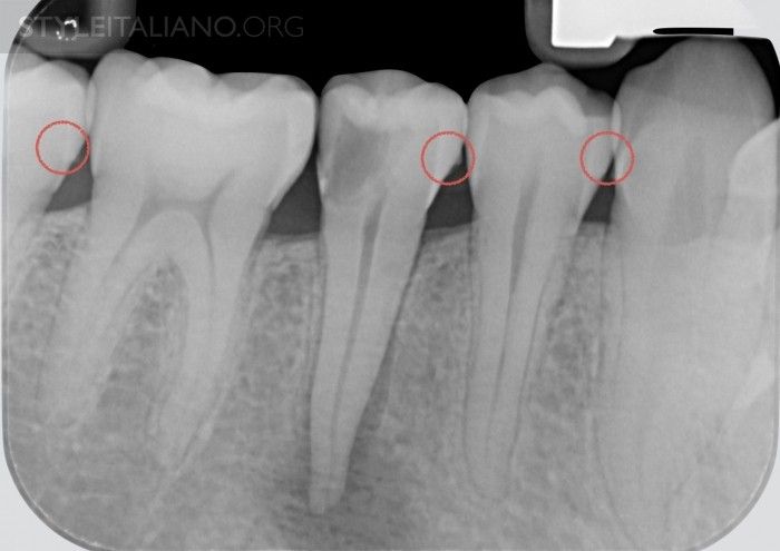 Good Manners for Good Endodontists