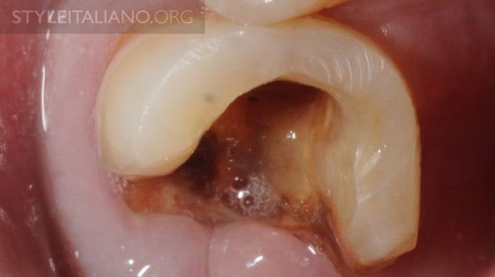 Good Manners for Good Endodontists