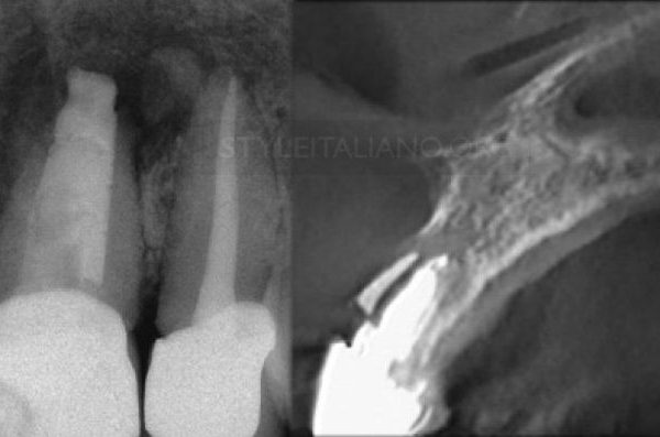CBCT: The dark side of the moon