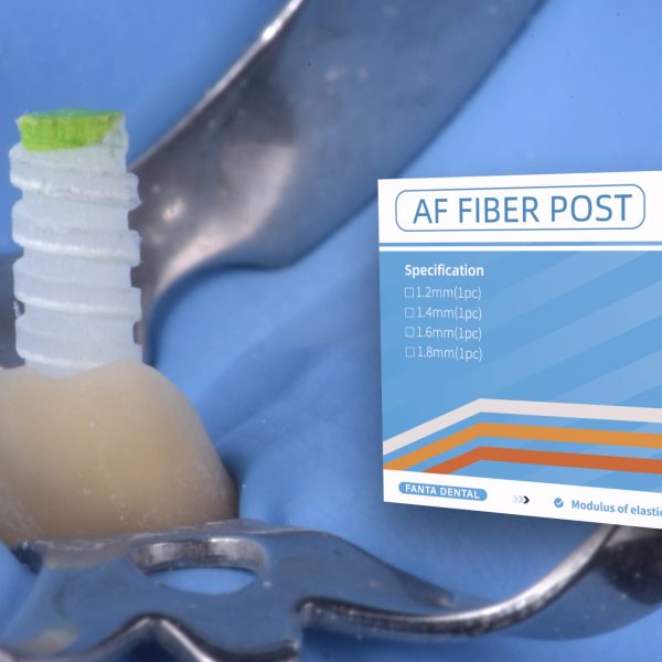 Guidelines for the correct selection and optimal luting of fiber posts