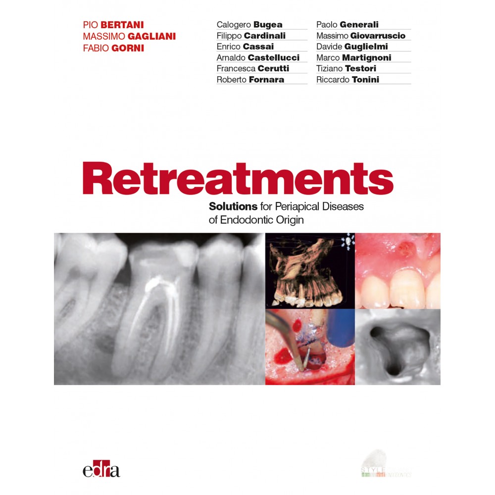 Retreatments, the Style Italiano Endodontics book