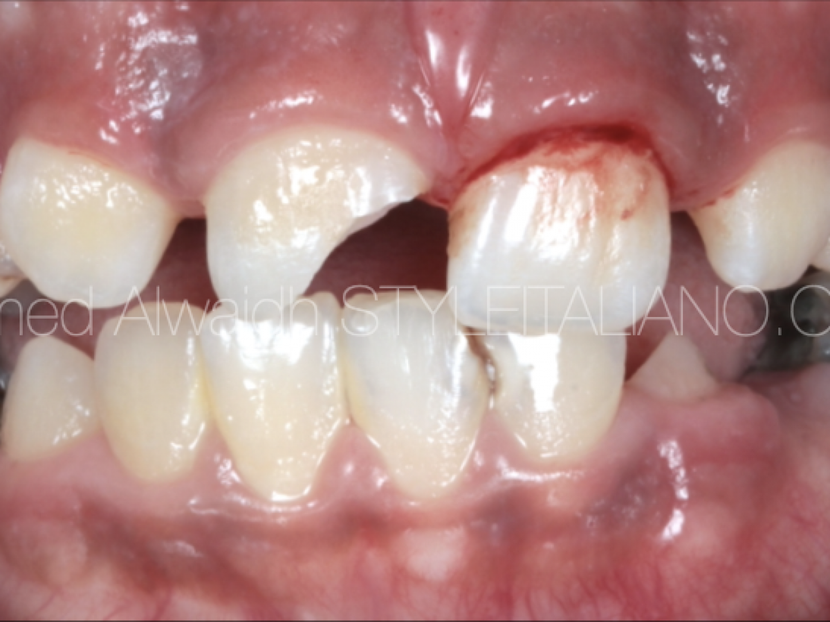 Schermata-2021-04-19-alle-16.