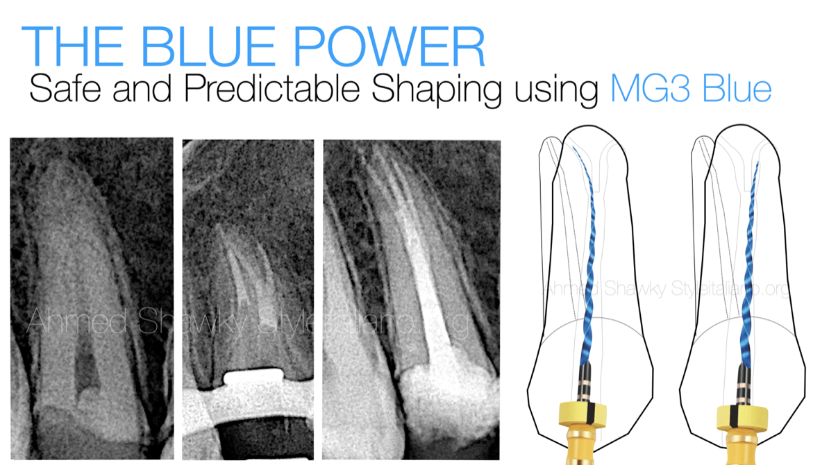 The Blue Power: Safe and Predictable Shaping using MG3 Blue
