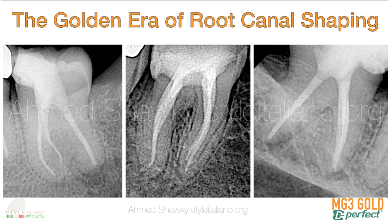 The Golden Era of root canal shaping
