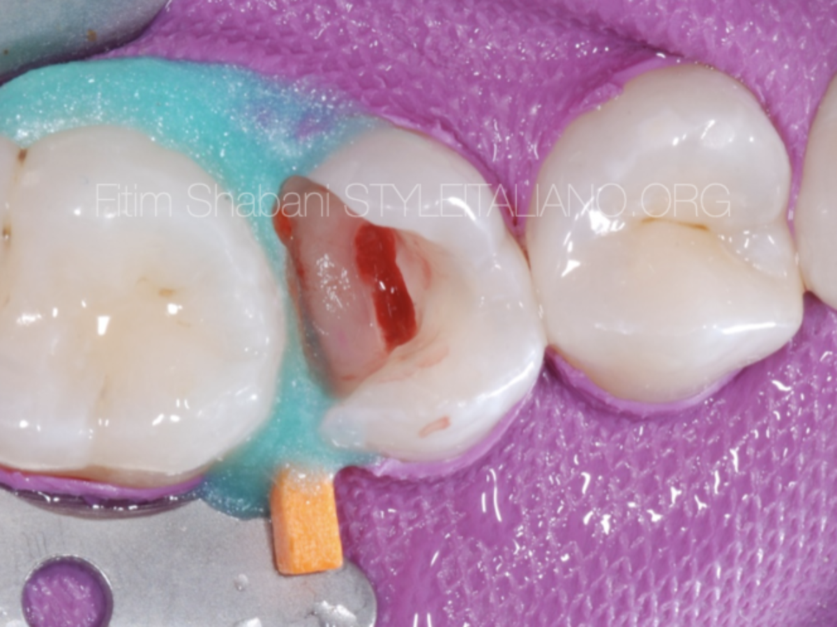 Schermata-2022-05-09-alle-23.