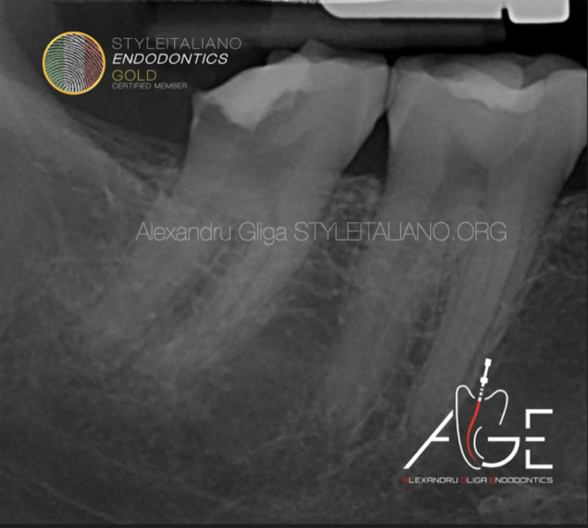 健康・医学 How to Endodontics The State of the Art Easy endodontics for clinical practice with color atlas
