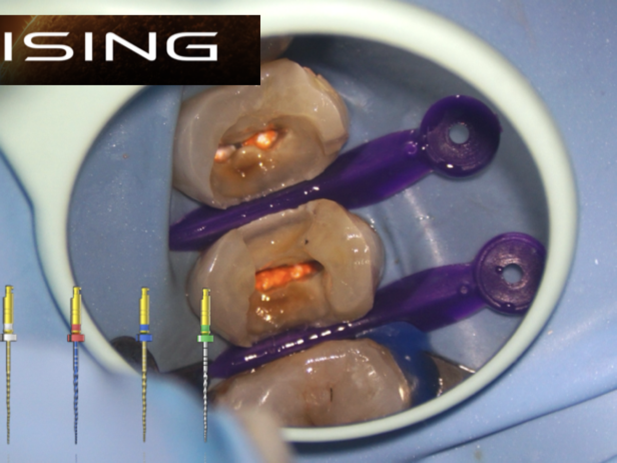 ビジュアライズド　イラストレーションズ　How to Endodontics ビジュアライズド イラストレーションズ How to Endodontics | 寺内 吉